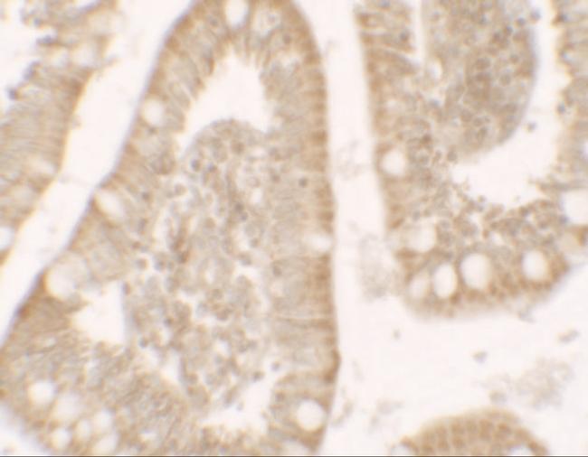 RC3H1 Antibody in Immunohistochemistry (IHC)