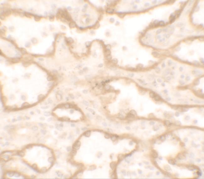 PTRF Antibody in Immunohistochemistry (IHC)