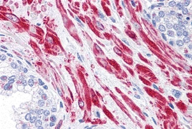 AS160 Antibody in Immunohistochemistry (IHC)