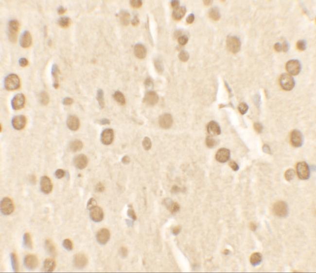 NUCB2 Antibody in Immunohistochemistry (IHC)