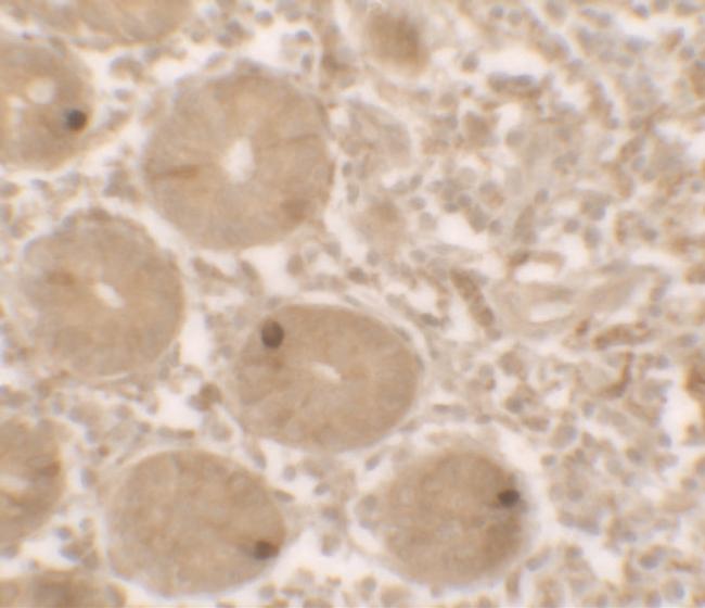 MTERFD2 Antibody in Immunohistochemistry (IHC)