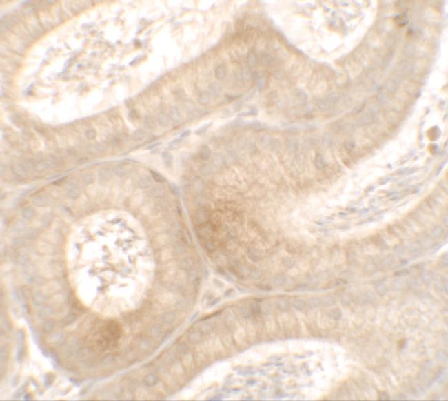 MTERFD3 Antibody in Immunohistochemistry (IHC)