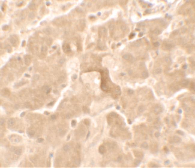 GBP5 Antibody in Immunohistochemistry (IHC)