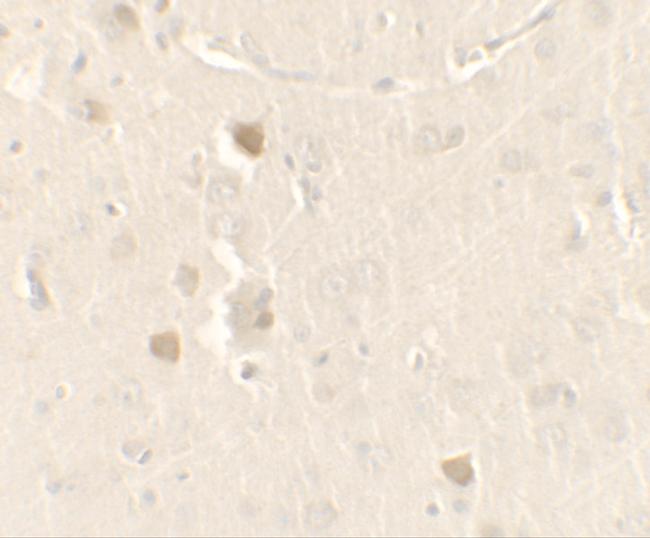 CISD2 Antibody in Immunohistochemistry (IHC)