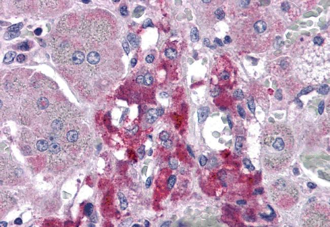 RIM2 Antibody in Immunohistochemistry (IHC)