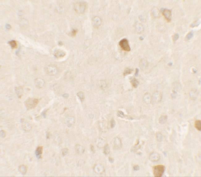 PRAS40 Antibody in Immunohistochemistry (IHC)