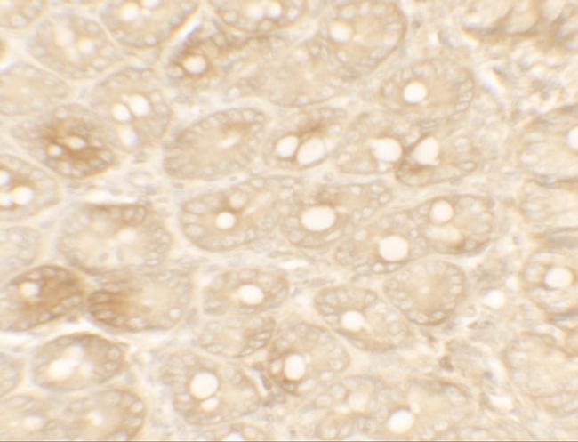 TFPI Antibody in Immunohistochemistry (IHC)