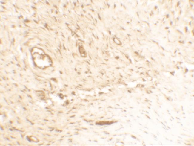 Osteopontin Antibody in Immunohistochemistry (IHC)