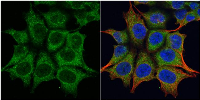 TRIM23 Antibody in Immunocytochemistry (ICC/IF)