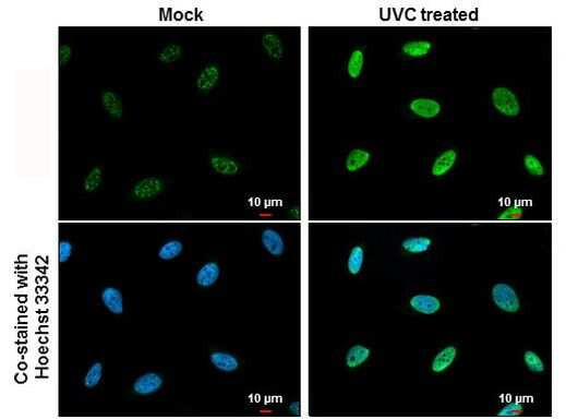 Phospho-CHK1 (Ser345) Antibody in Immunocytochemistry (ICC/IF)