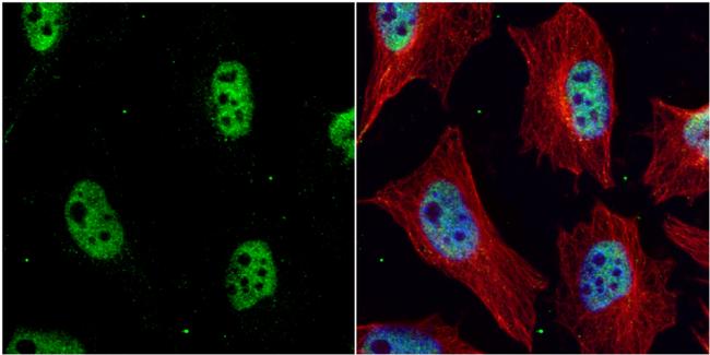 Chk1 Antibody in Immunocytochemistry (ICC/IF)