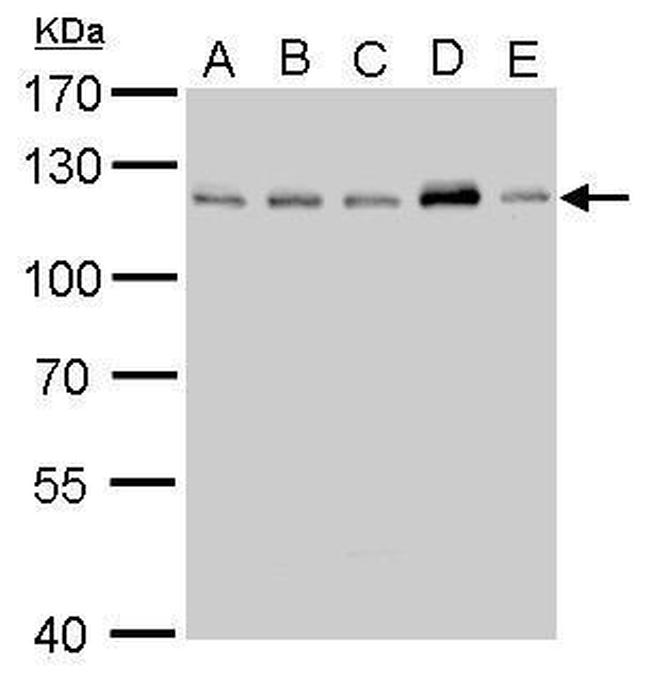 CYLD Antibody in Western Blot (WB)