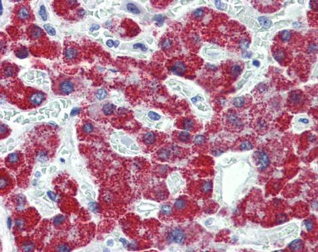 ACADS Antibody in Immunohistochemistry (Paraffin) (IHC (P))