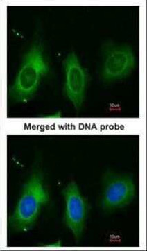 Periostin Antibody in Immunocytochemistry (ICC/IF)