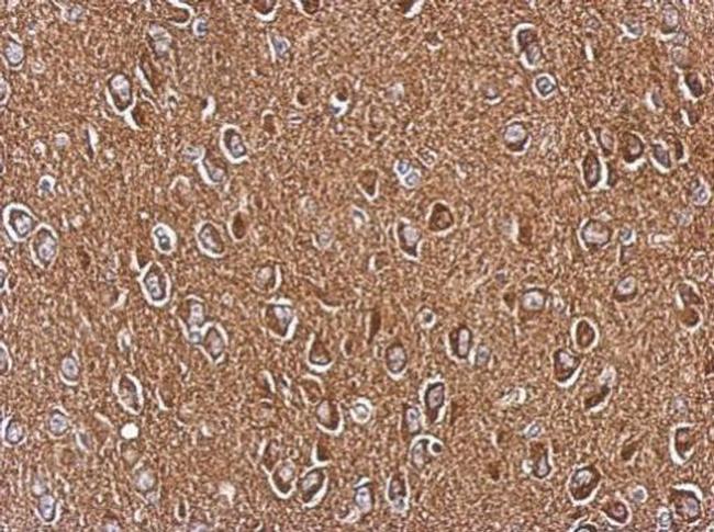 Axl Antibody in Immunohistochemistry (Paraffin) (IHC (P))