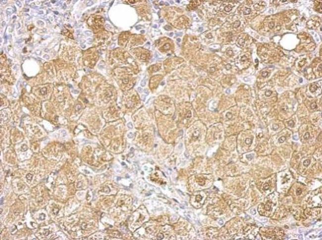 Aldolase B Antibody in Immunohistochemistry (Paraffin) (IHC (P))