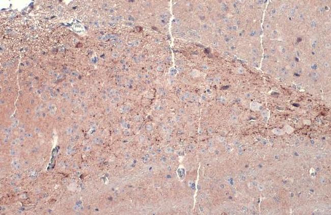 Dopamine beta Hydroxylase Antibody in Immunohistochemistry (Paraffin) (IHC (P))