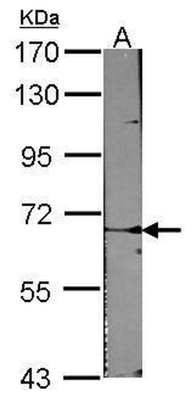 ACVRL1 Antibody in Western Blot (WB)