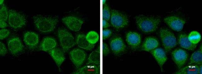 ACAT1 Antibody in Immunocytochemistry (ICC/IF)