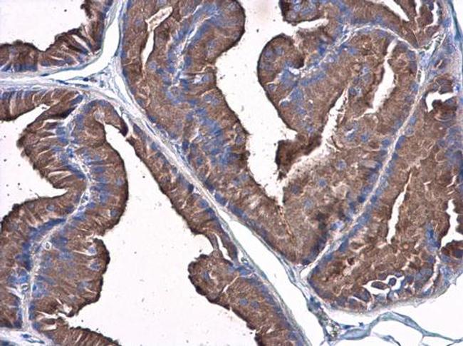 Plasminogen Antibody in Immunohistochemistry (Paraffin) (IHC (P))