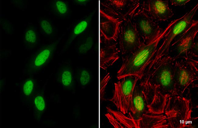 Cyclin A2 Antibody in Immunocytochemistry (ICC/IF)