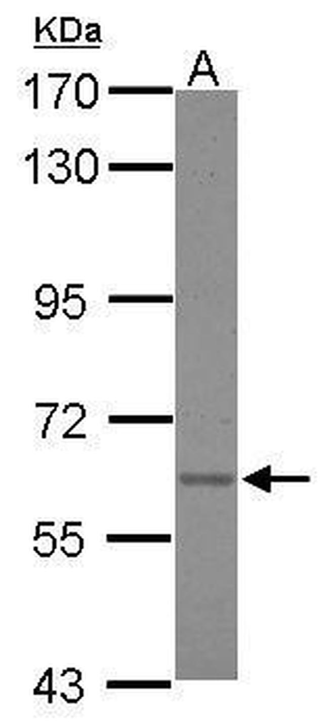 Asparagine Synthetase Antibody in Western Blot (WB)