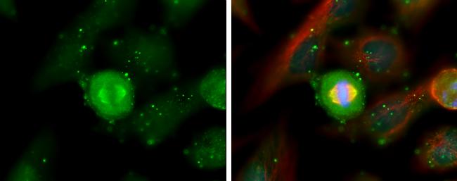 Aurora A Antibody in Immunocytochemistry (ICC/IF)