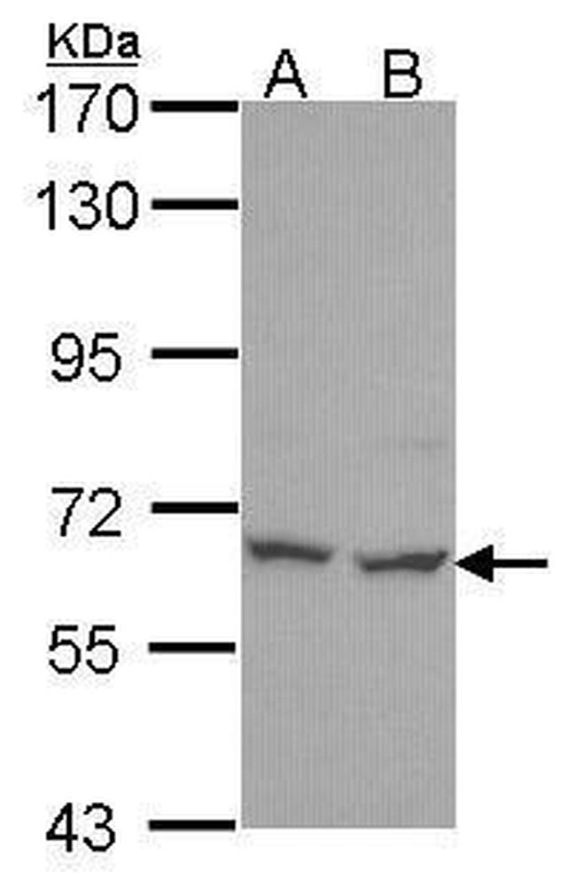 PNK Antibody in Western Blot (WB)