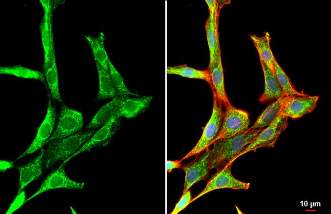 PDGFRA Antibody in Immunocytochemistry (ICC/IF)