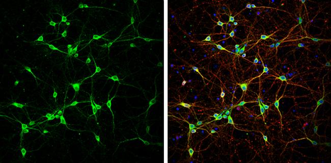 NF-H Antibody in Immunocytochemistry (ICC/IF)