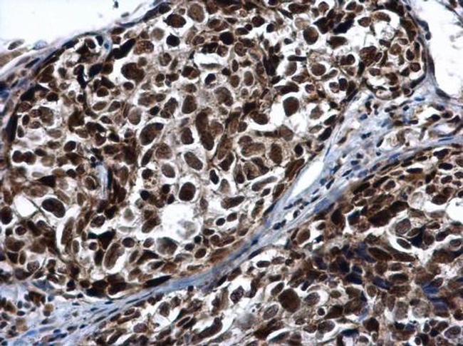 PRP19 Antibody in Immunohistochemistry (Paraffin) (IHC (P))