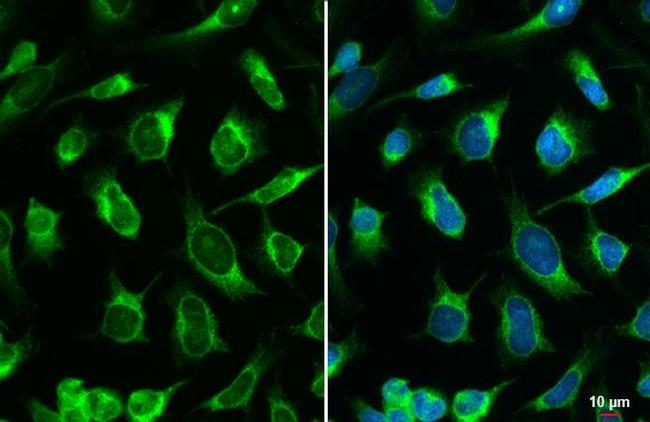 Calreticulin Antibody in Immunocytochemistry (ICC/IF)