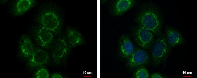 Fibulin 3 Antibody in Immunocytochemistry (ICC/IF)