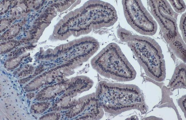 TIP60 Antibody in Immunohistochemistry (Paraffin) (IHC (P))