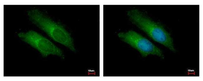 Bcl-10 Antibody in Immunocytochemistry (ICC/IF)