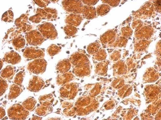 IL-21 Antibody in Immunohistochemistry (Paraffin) (IHC (P))