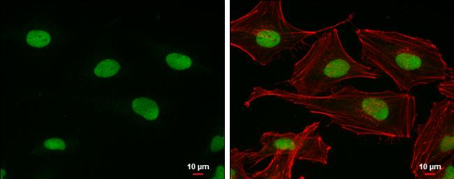 PARP1 Antibody in Immunocytochemistry (ICC/IF)