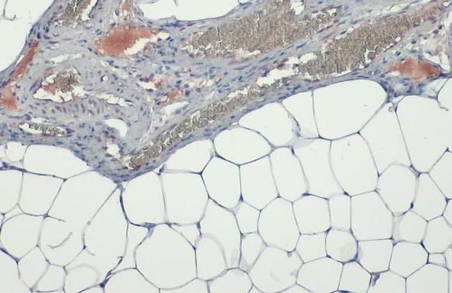 LPL Antibody in Immunohistochemistry (Paraffin) (IHC (P))