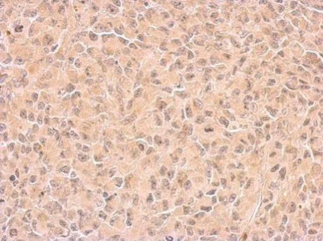 COX1 Antibody in Immunohistochemistry (Paraffin) (IHC (P))