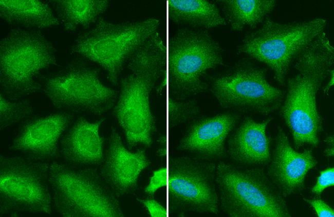 STAT6 Antibody in Immunocytochemistry (ICC/IF)