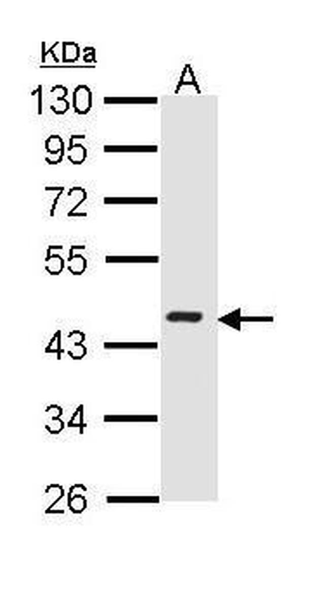 ICAD Antibody in Western Blot (WB)