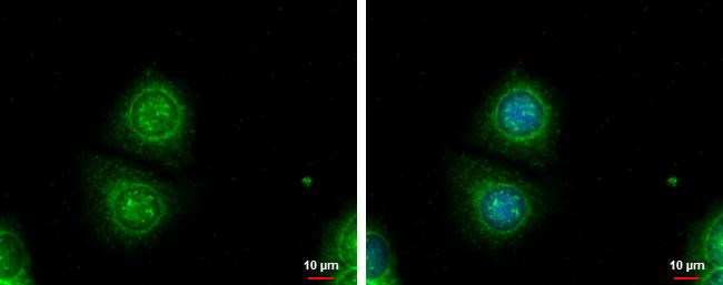 Galectin 3 Antibody in Immunocytochemistry (ICC/IF)