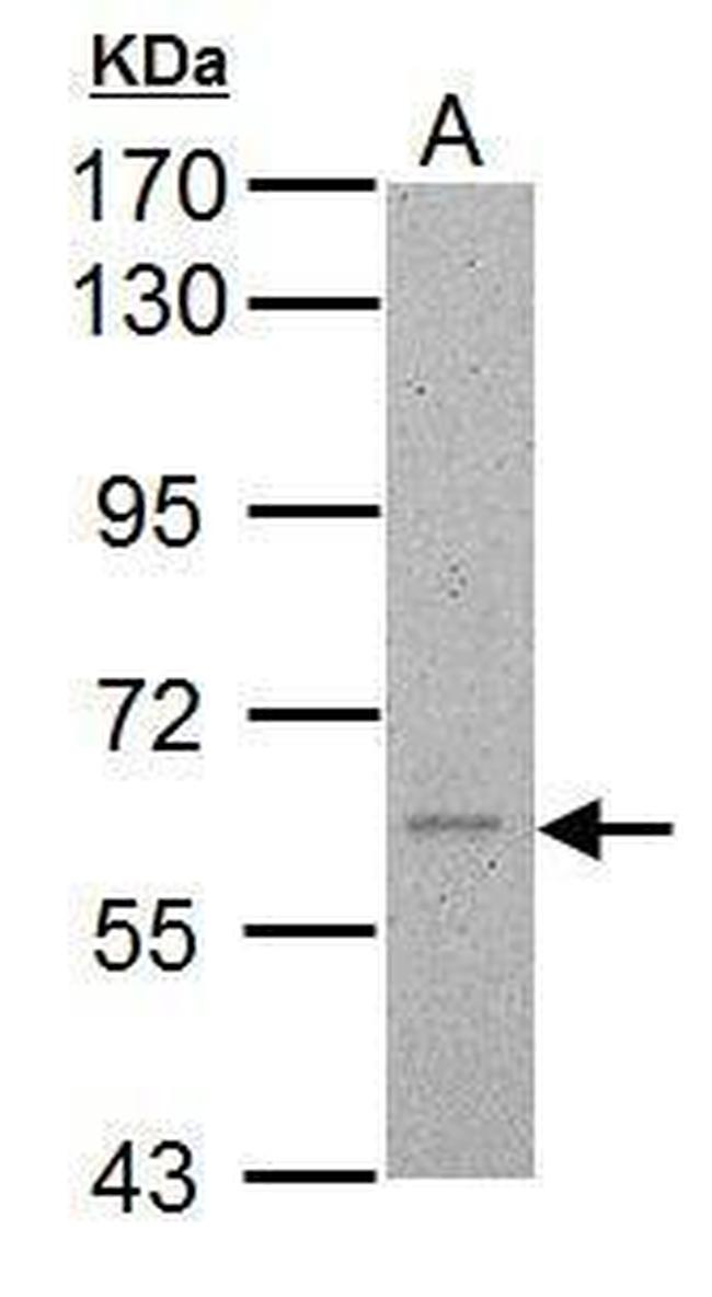 Calcium Channel beta-4 Antibody in Western Blot (WB)