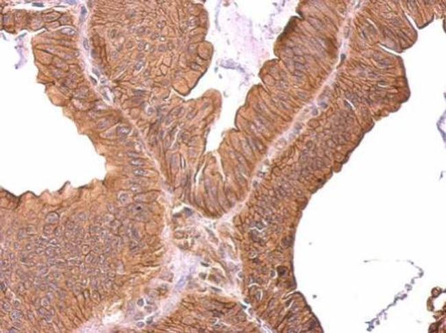 ROBO1 Antibody in Immunohistochemistry (Paraffin) (IHC (P))