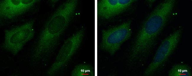 UNG Antibody in Immunocytochemistry (ICC/IF)