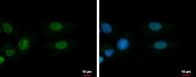 ADARB1 Antibody in Immunocytochemistry (ICC/IF)