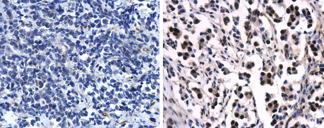 Progesterone Receptor Antibody in Immunohistochemistry (Paraffin) (IHC (P))