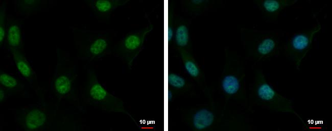 CUG-BP2 Antibody in Immunocytochemistry (ICC/IF)