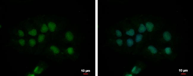 CPSF2 Antibody in Immunocytochemistry (ICC/IF)