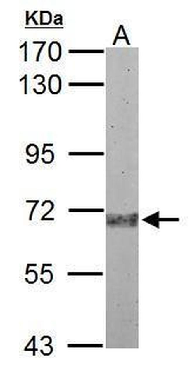 Plasma Kallikrein Antibody in Western Blot (WB)